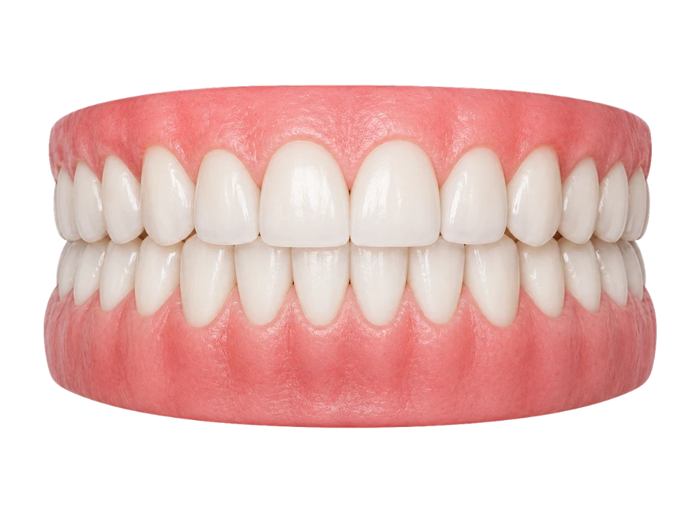 Crossbite — After